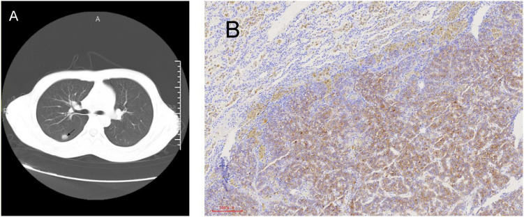 Figure 2