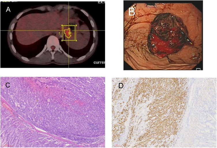 Figure 3