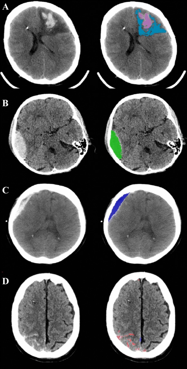 Fig. 1