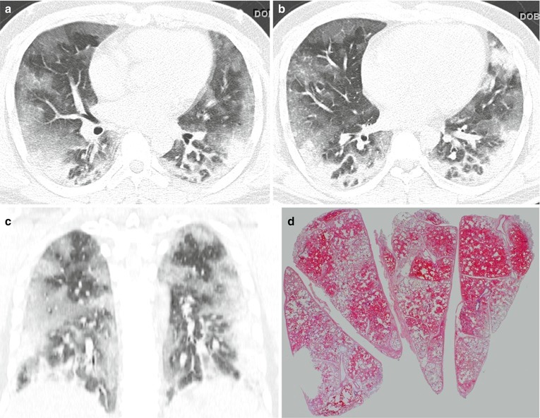 Fig. 22.8