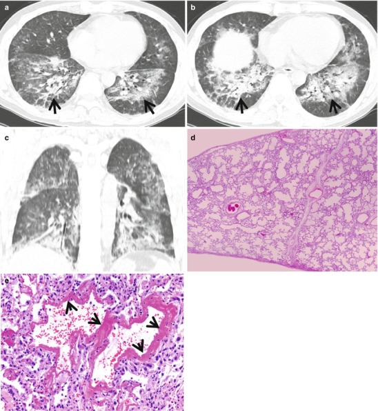 Fig. 22.6