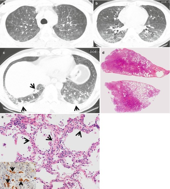 Fig. 22.5