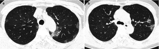 Fig. 22.2