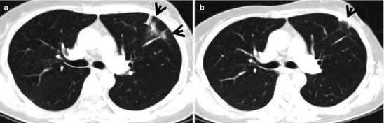 Fig. 22.4