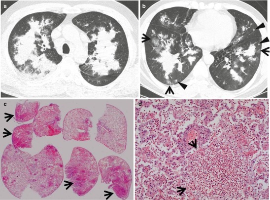 Fig. 22.3