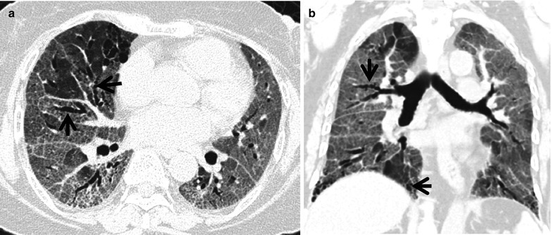 Fig. 22.7