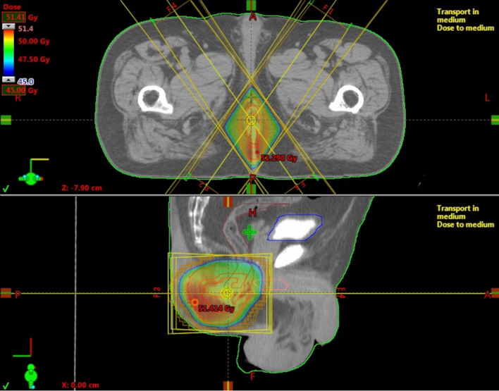 Fig. 3