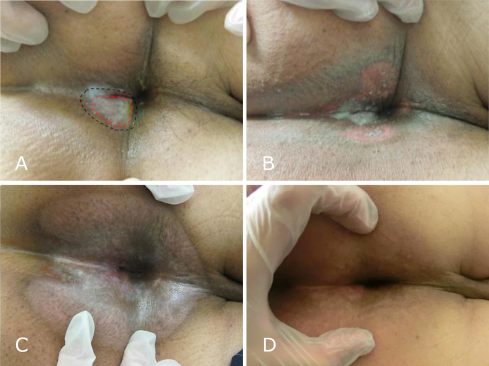 Fig. 4