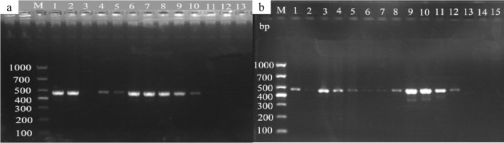Gel electrophoresis results in two panels labeled “a” and “b”. Panel “a” has lanes M and 1 to 13, with bright bands mainly around the 500 base pairs mark. Panel “b” has lanes M and 1 to 15, with distinct bands near 400 to 500 base pairs. Molecular weight markers are labeled on the left side of each gel.