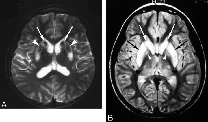 Fig 2.