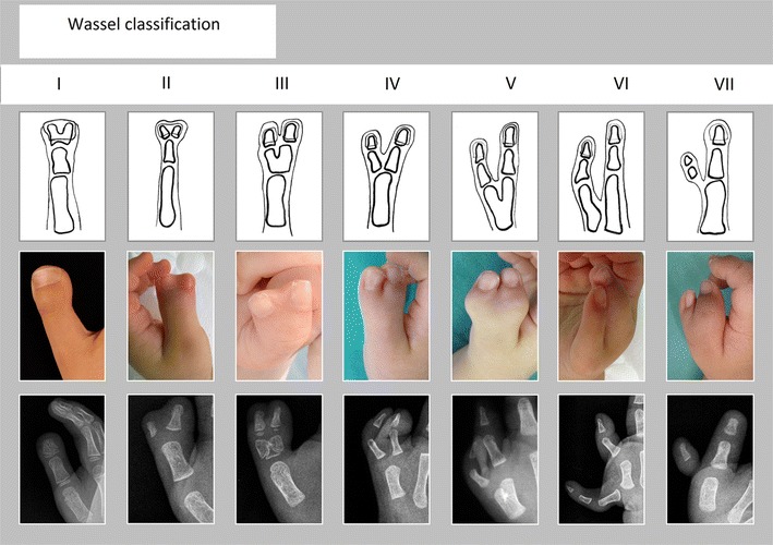 Fig. 3