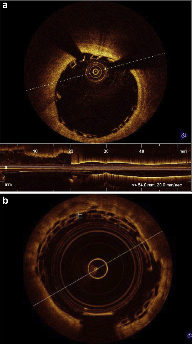 Fig. 6