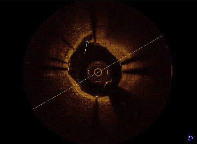 Fig. 3