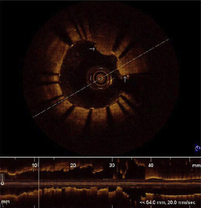 Fig. 4