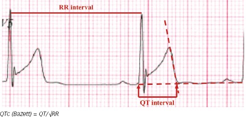 Figure 1: