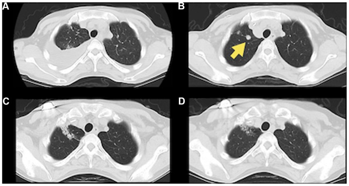 Figure 3.