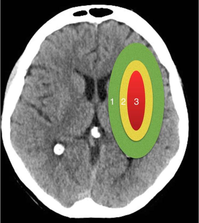 Figure 1.