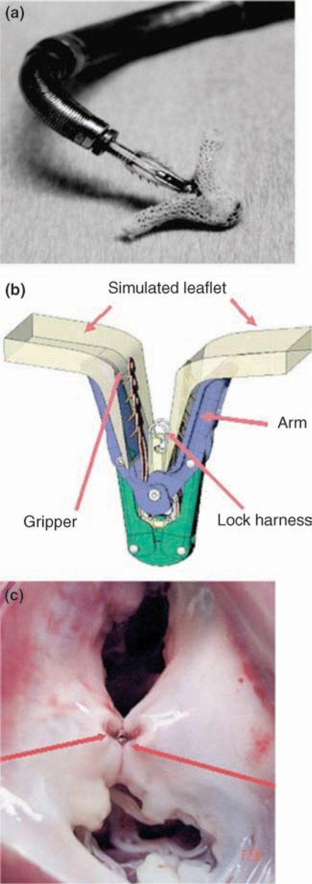 Fig 4.