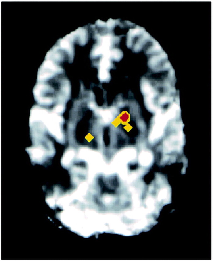 fig 3.