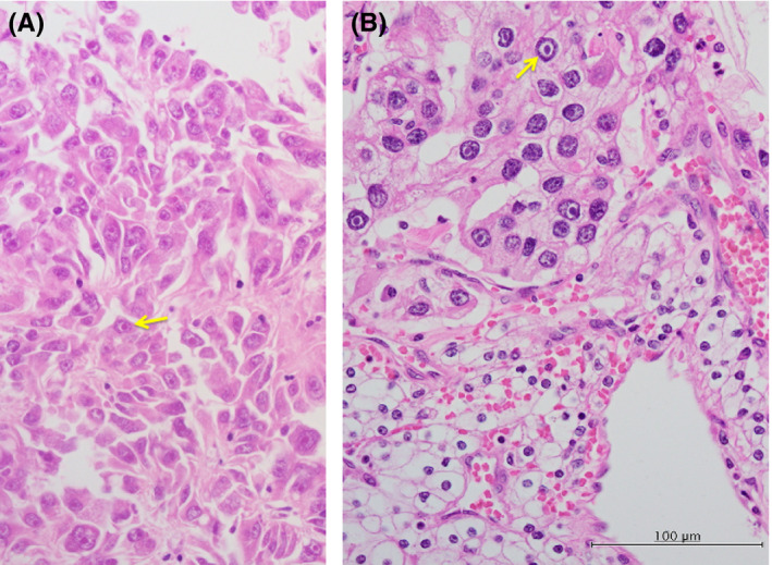 FIGURE 2