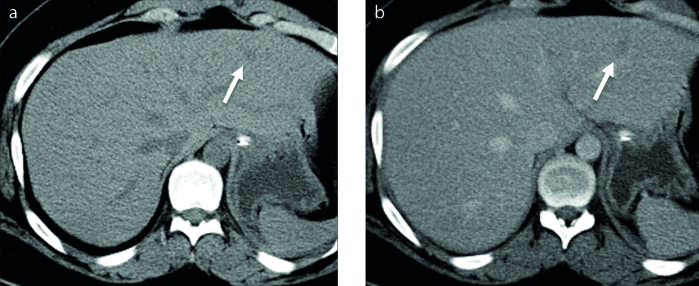 Figure 2. a, b