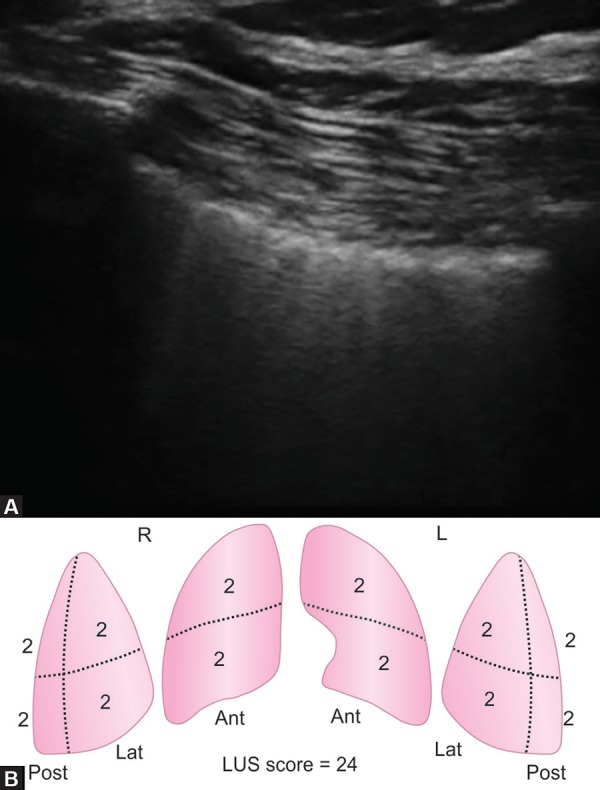 Figs 2A and B