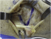 Figure 23