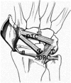 Figure 25