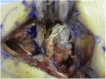 Figure 22