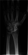 Figure 16