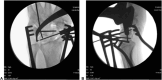 Figure 27