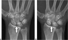 Figure 32