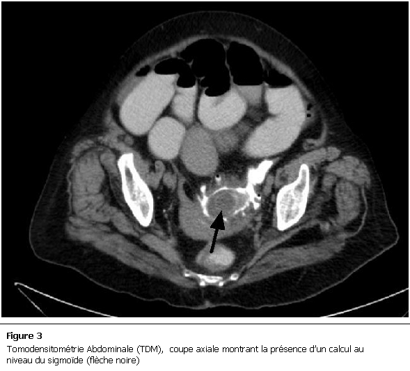 Figure 3: