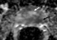 Figure 3b: