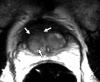 Figure 2a: