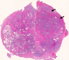 Figure 1d: