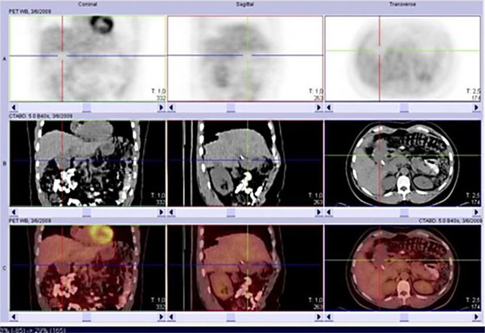 Fig. 2