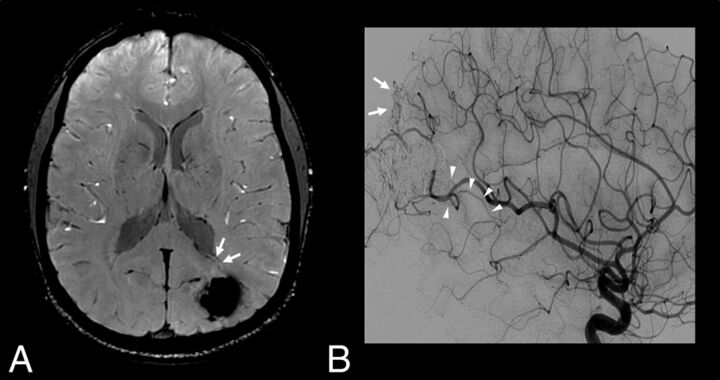 Fig 5.