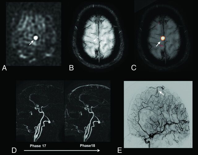 Fig 3.