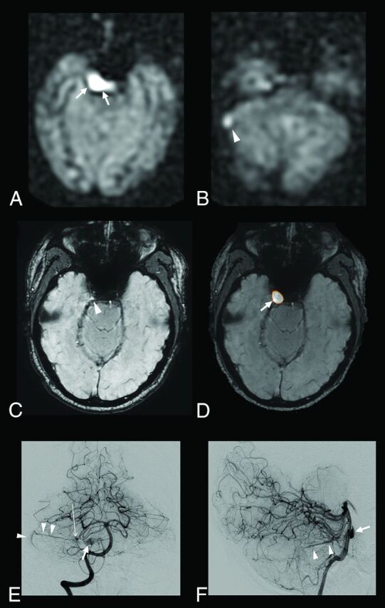 Fig 4.