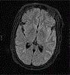 Fig 3.