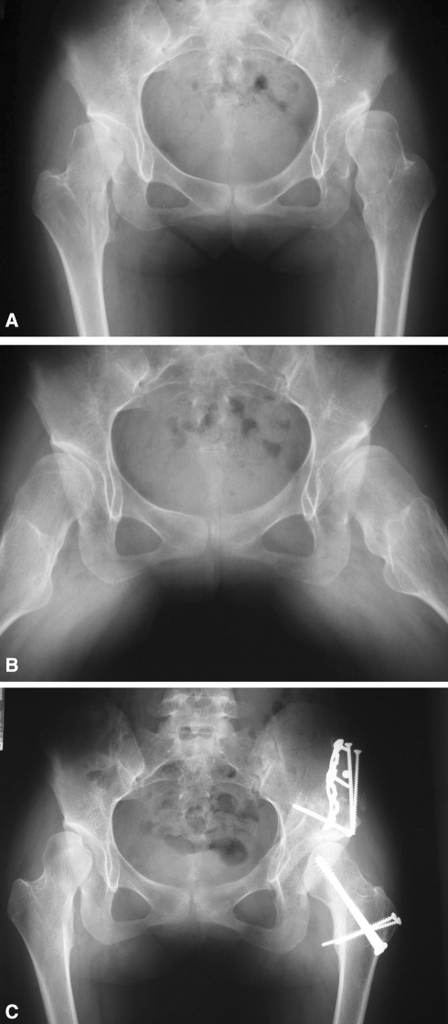 Fig. 10A–C