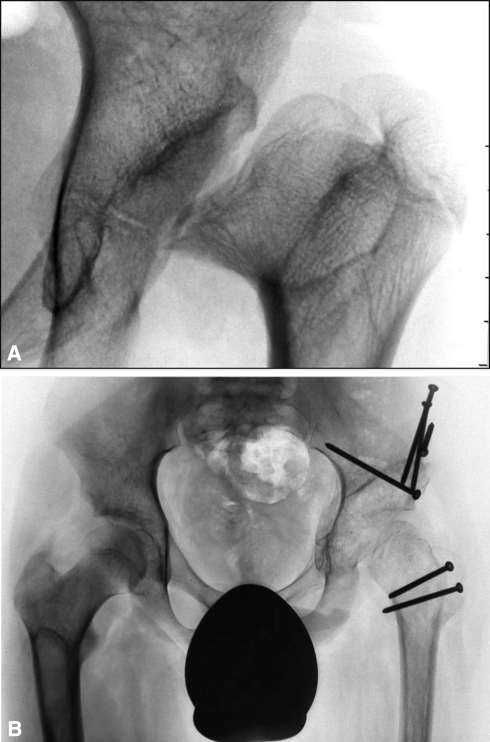 Fig. 8A–B