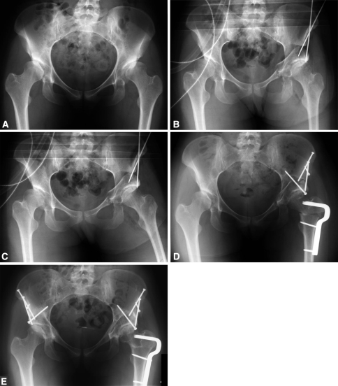 Fig. 7A–E