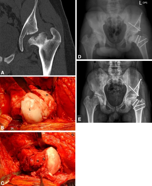 Fig. 11A–E