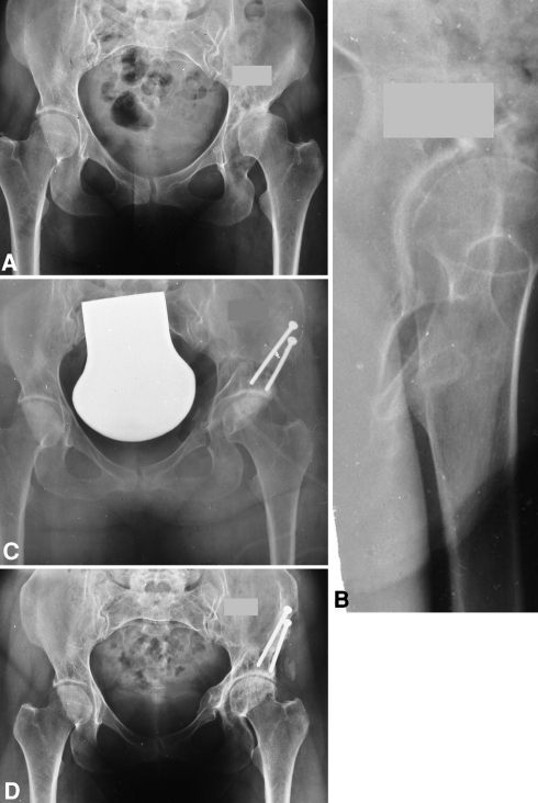 Fig. 3A–D