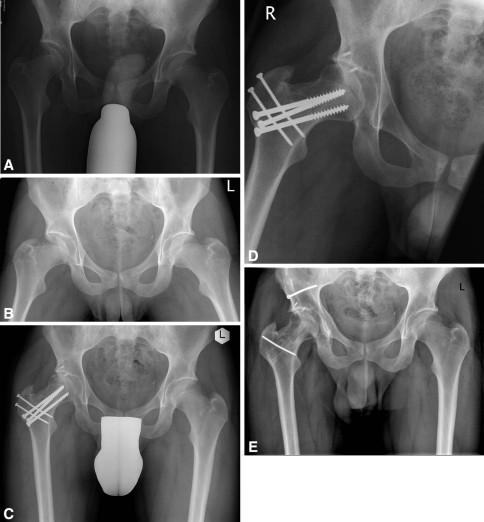 Fig. 13A–E