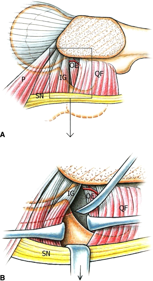 Fig. 12A–B