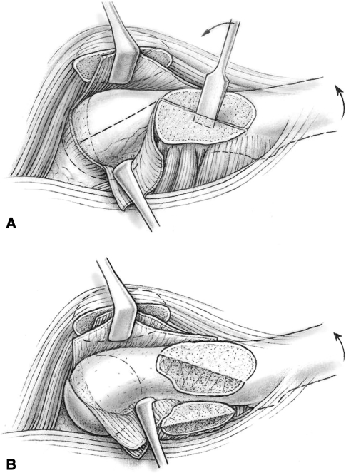 Fig. 9A–B