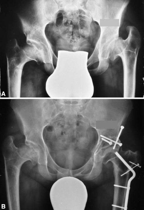 Fig. 5A–B